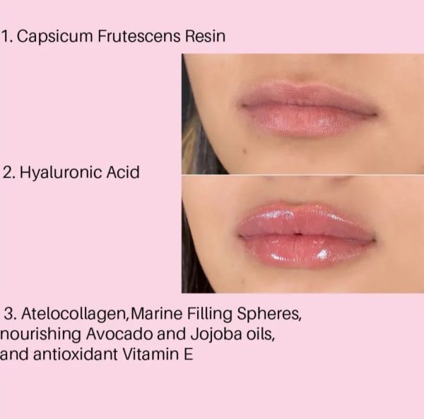 Hydrochloride Acid Lip Plumper - Image 3